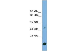 WB Suggested Anti-RAB9A Antibody Titration:  0. (RAB9A 抗体  (Middle Region))