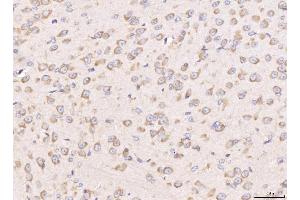 IHC analysis of RPL29 using anti-RPL29 antibody (ABIN7600993). (RPL29 抗体  (AA 27-153))