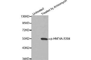 Western blot analysis of extracts from Hela cells, using Phospho-HNF4A-S304 antibody. (HNF4A 抗体  (pSer304))