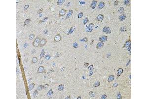 Immunohistochemistry of paraffin-embedded Rat brain using CDH16 Polyclonal Antibody at dilution of 1:100 (40x lens). (Cadherin-16 抗体)