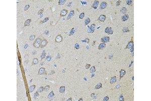 Immunohistochemistry of paraffin-embedded Rat brain using CDH16 Polyclonal Antibody at dilution of 1:100 (40x lens).