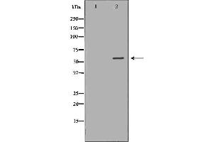 Western blot analysis of Hela whole cell lysates, using AIRE Antibody. (AIRE 抗体  (Internal Region))