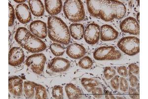 Immunoperoxidase of monoclonal antibody to PAK1 on formalin-fixed paraffin-embedded human stomach. (PAK1 抗体  (AA 191-280))