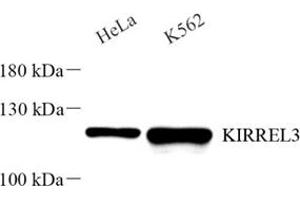 Western blot analysis of KIRREL3 (ABIN7074434) at dilution of 1: 2000 (KIRREL3 抗体)