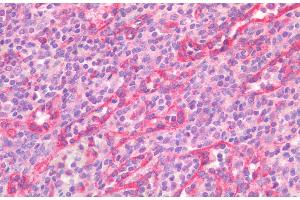 (ABIN5539582) (5 μg/mL) staining of paraffin embedded Human Spleen. (STAT5A 抗体  (AA 681-692))