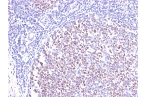 Formalin-fixed, paraffin-embedded human Tonsil stained with BCL-6 Rabbit Recombinant Monoclonal Antibody (BCL6/2497R). (Recombinant BCL6 抗体  (AA 256-389))