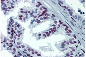 Human Prostate: Formalin-Fixed, Paraffin-Embedded (FFPE) (SP1 抗体  (AA 89-199))
