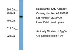 WB Suggested Anti-PKM2  Antibody Titration: 0. (PKM2 抗体  (Middle Region))