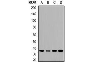 Western blot analysis of TMBIM1 expression in HeLa (A), HepG2 (B), mouse brain (C), rat kidney (D) whole cell lysates. (TMBIM1 抗体  (C-Term))
