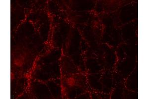 Indirect immunostaining of PFA fixed rat hippocampus neurons (dilution 1 : 500). (TMEM163 抗体  (AA 44-63))
