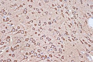 Immunohistochemistry of paraffin-embedded rat brain using eEF1G Rabbit mAb (ABIN7267024) at dilution of 1:100 (40x lens). (EEF1G 抗体)