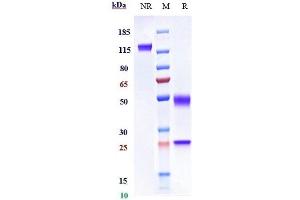 Anti-HGF / SF Reference Antibody (rilotumumab) on SDS-PAGE under reducing (R) condition. (Recombinant HGF (Rilotumumab Biosimilar) 抗体)