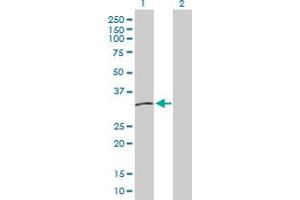 anti-Major Histocompatibility Complex, Class II, DM beta (HLA-DMB) (AA 1-263) antibody