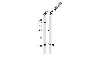 Western blot analysis of lysates from Hela, MDA-MB-468 cell line (from left to right), using SNRPG Antibody (N-term) (ABIN6242749 and ABIN6577533). (SNRPG 抗体  (N-Term))