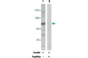 Western blot analysis of extracts from 293 cells, treated with insulin (0. (BRAF 抗体)