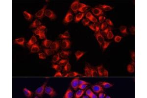 Immunofluorescence analysis of HeLa cells using ARHGAP1 Polyclonal Antibody at dilution of 1:100. (ARHGAP1 抗体)