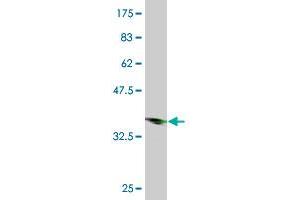 Western Blot detection against Immunogen (36. (HOXC13 抗体  (AA 132-231))