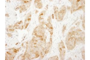 Immunohistochemistry (IHC) image for anti-Ribosomal Protein S6 (RPS6) (C-Term) antibody (ABIN7449016) (RPS6 抗体  (C-Term))