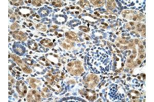 ZNF169 antibody was used for immunohistochemistry at a concentration of 4-8 ug/ml to stain Epithelial cells of renal tubule (arrows) in Human Kidney. (ZNF169 抗体  (Middle Region))