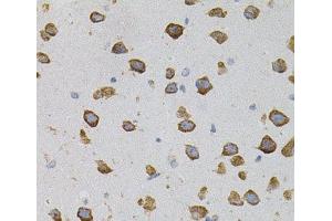Immunohistochemistry of paraffin-embedded Mouse brain using VEGFC Polyclonal Antibody (VEGFC 抗体)