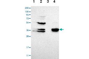 Western blot analysis of Lane 1: Human cell line RT-4, Lane 2: Human cell line U-251MG sp, Lane 3: Human plasma (IgG/HSA depleted), Lane 4: Human liver tissue with CGRRF1 polyclonal antibody  at 1:100-1:250 dilution. (CGR19 抗体)