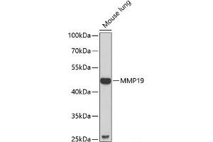 Western blot analysis of extracts of Mouse lung using MMP19 Polyclonal Antibody at dilution of 1:1000. (MMP19 抗体)