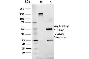 SDS-PAGE Analysis Purified Fibronectin Mouse Monoclonal Antibody (Fn-3). (Fibronectin 1 抗体)