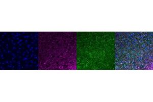 Immunohistochemistry (IHC) image for anti-Microtubule-Associated Protein 2 (MAP2) antibody (ABIN7456240) (MAP2 抗体)