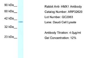 Human Daudi; WB Suggested Anti-HMX1 AntibodyTitration: 4. (HMX1 抗体  (Middle Region))