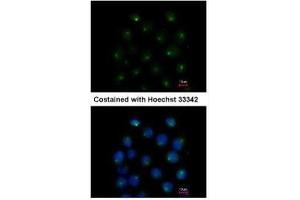 ICC/IF Image Immunofluorescence analysis of methanol-fixed A431, using SAR1A, antibody at 1:500 dilution. (SAR1A 抗体  (Center))