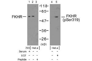 Image no. 2 for anti-Forkhead Box O1 (FOXO1) (pSer319) antibody (ABIN196849) (FOXO1 抗体  (pSer319))
