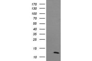 Image no. 1 for anti-D-Dopachrome Tautomerase (DDT) antibody (ABIN1497794)