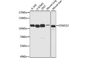 Western blot analysis of extracts of various cell lines, using COLEC12 antibody. (COLEC12 抗体  (AA 60-270))