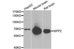 Western blot analysis of extracts of various cell lines, using MPP2 antibody. (MPP2 抗体)