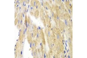 Immunohistochemistry of paraffin-embedded mouse heart using KRT19 antibody (ABIN5970077) at dilution of 1/100 (40x lens). (Cytokeratin 19 抗体)