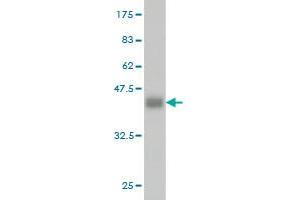Western Blot detection against Immunogen (36. (ADH4 抗体  (AA 52-150))