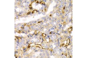 Immunohistochemistry of paraffin-embedded rat kidney using NEFL antibody. (NEFL 抗体)