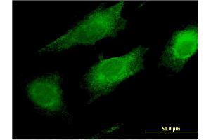 Immunofluorescence of monoclonal antibody to FAIM2 on HeLa cell. (FAIM2 抗体  (AA 1-316))