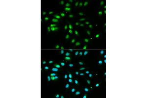 Immunofluorescence analysis of MCF7 cell using PAX3 antibody. (Paired Box 3 抗体  (AA 1-206))