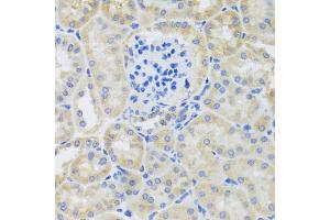 Immunohistochemistry of paraffin-embedded mouse kidney using BNIP3 antibody. (BNIP3 抗体)