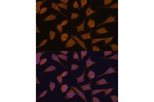 Immunofluorescence analysis of L929 cells using 43711 antibody (ABIN7270204) at dilution of 1:100. (Septin 3 抗体  (AA 179-358))