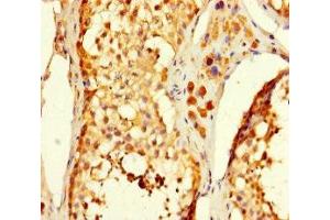Immunohistochemistry of paraffin-embedded human testis tissue using ABIN7175061 at dilution of 1:100 (C5orf51 抗体  (AA 8-152))
