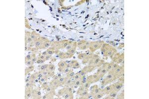 Immunohistochemistry of paraffin-embedded human liver injury using LETMD1 antibody at dilution of 1:100 (x40 lens). (LETMD1 抗体)