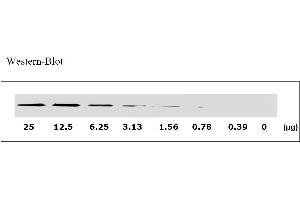 Image no. 3 for Epidermal Growth Factor Receptor (EGFR) ELISA Kit (ABIN625224)