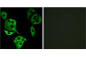 Immunofluorescence analysis of A549 cells, using ADCK4 Antibody. (ADCK4 抗体  (AA 31-80))