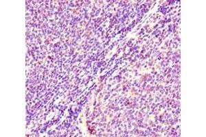Immunohistochemistry of paraffin-embedded human lymphoid tissue using ABIN7178885 at dilution of 1:100 (HRAS 抗体  (AA 2-186))