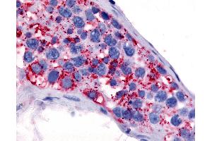 Anti-5HT1E Receptor antibody IHC of human testis. (Serotonin Receptor 1E 抗体  (Cytoplasmic Domain))