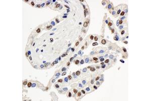 Immunohistochemistry (IHC) image for anti-SWI/SNF Related, Matrix Associated, Actin Dependent Regulator of Chromatin, Subfamily E, Member 1 (SMARCE1) (C-Term) antibody (ABIN7454676)