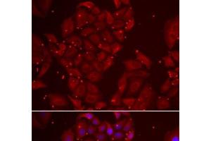 Immunofluorescence analysis of U2OS cells using TPP2 Polyclonal Antibody (Tpp2 抗体)