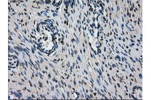 Immunohistochemical staining of paraffin-embedded colon tissue using anti-L1CAMmouse monoclonal antibody. (L1CAM 抗体)